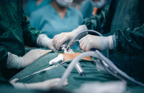 Minimally Invasive Surgery (Laparoscopic & Robotic)
