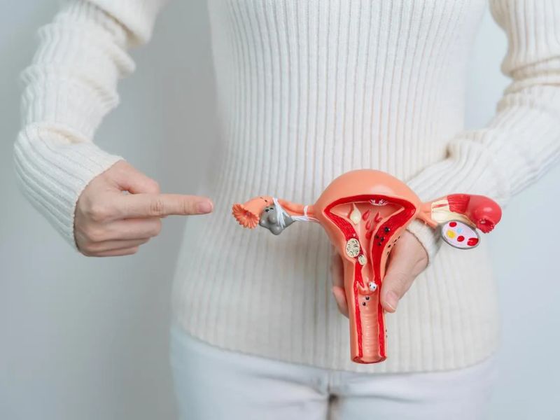 cervical cancer