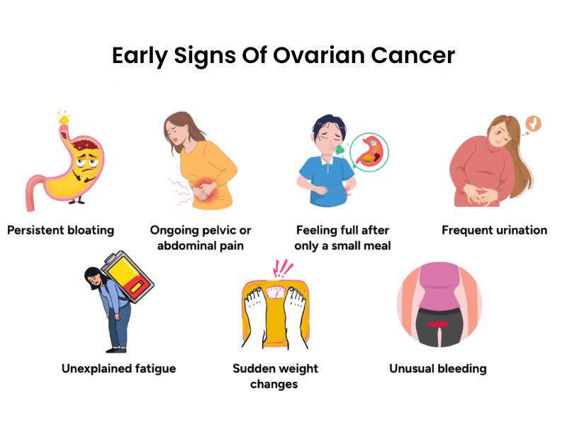 Ovarian cancer