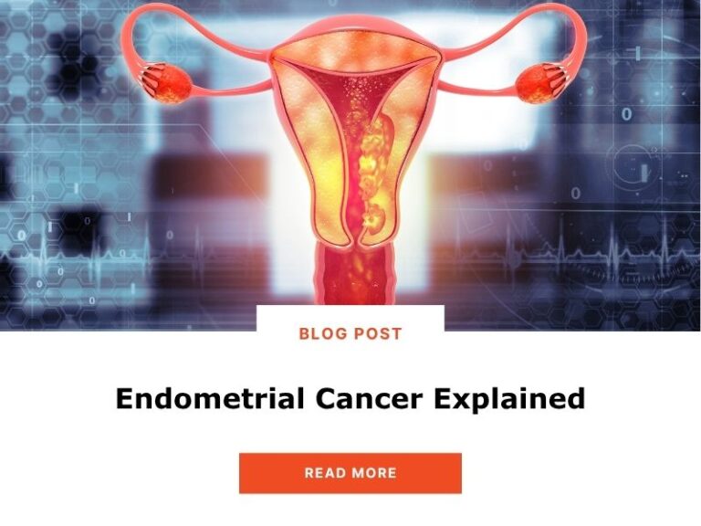 Endometrial Cancer