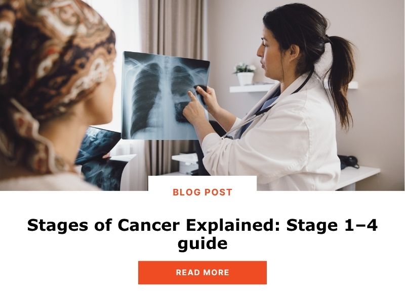Stages of Cancer Explained